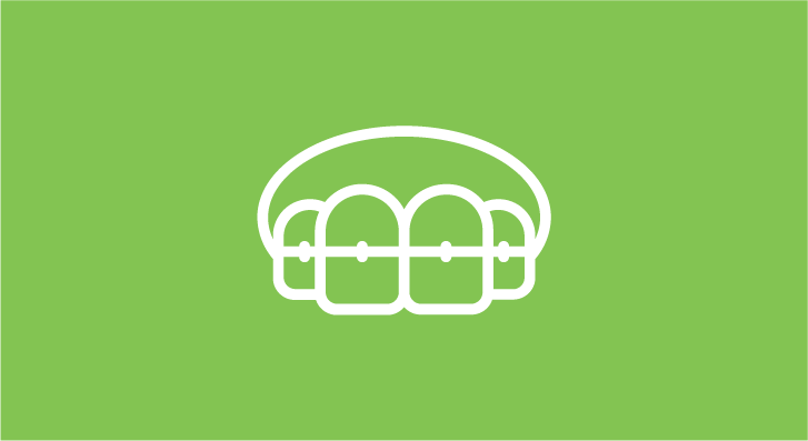 Установка брекетов в Харькове - Dental Line