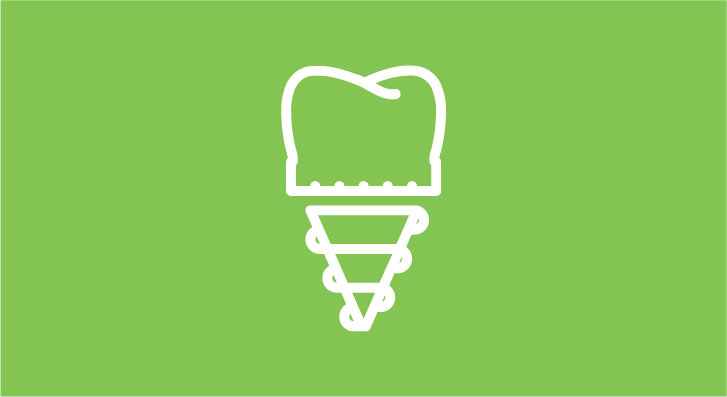 Имплантация зубов в Харькове - Dental Line