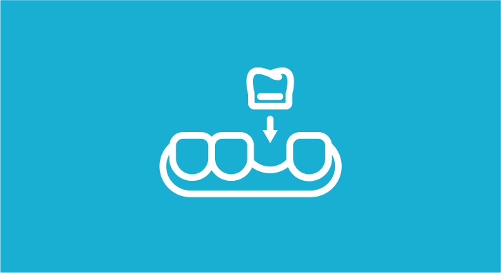 Протезировние зубов в Харькове - Dental Line