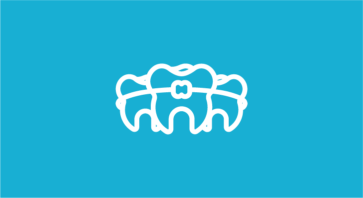 Выравнивание зубов в Харькове - Dental Line