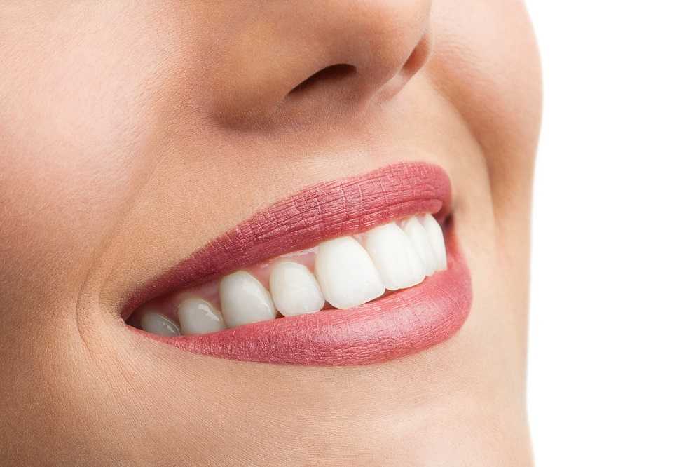 Портятся ли зубы под винирами - dentalline.com.ua - фото
