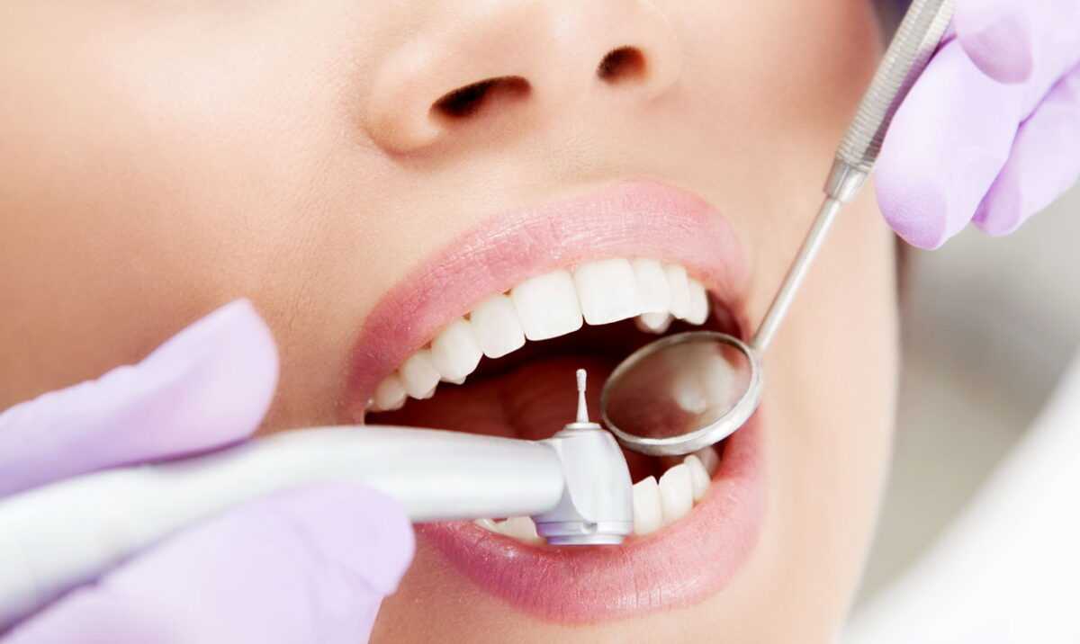 Лечение кариеса в Харькове - dentalline.com.ua - фото