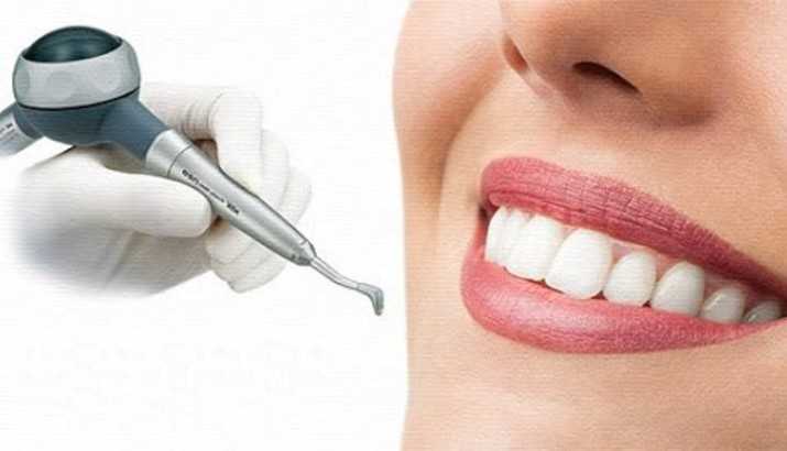 Чистка зубов air flow - стоматология Dental Line Харьков - фото- 2
