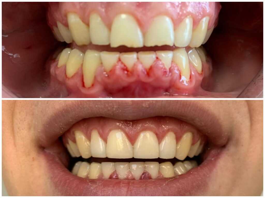 Реставрация зубов - Dental Line - фото 2