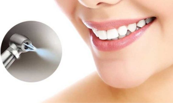 Чистка зубов air flow - dentalline.com.ua - фото