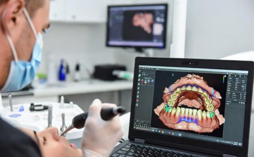 Интраоральное 3D-сканирование зубов - стоматология Dental Line в Харькове - фото
