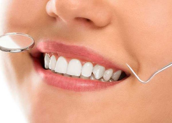 Как часто нужно посещать стоматолога - стоматология Dental Line в Харькове - фото