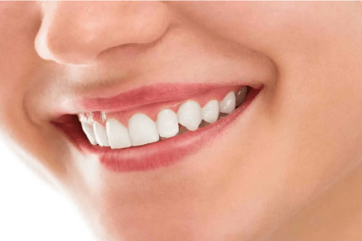 Как сохранить здоровье дёсен - dentalline.com.ua - фото