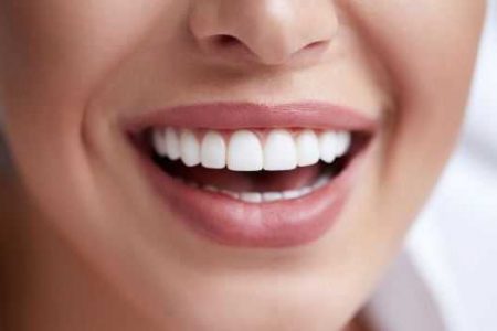 Отбеливание зубов - мифы и факты - dentalline.com.ua - фото