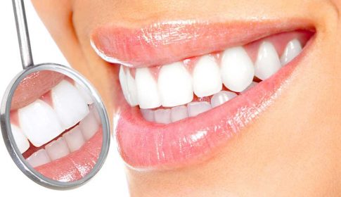 Почему разрушается эмаль зубов - стоматология Dental Line в Харькове - фото