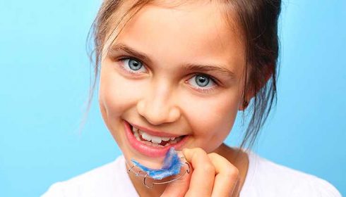 Исправление прикуса у ребенка -dentalline.com.ua - фото