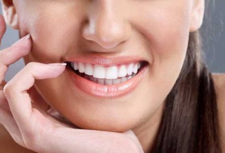 Стоит ли ставить виниры и зачем они нужны - dentalline.com.ua - фото