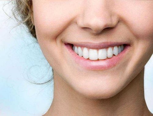 Стоит ли ставить виниры - стоматология Dental Line в Харькове - фото